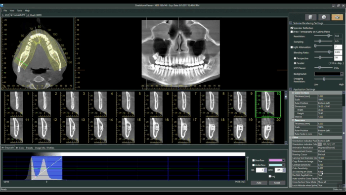 CBCT viewer showing the traced arch curve highlighted in yellow, the resulting panoramic reconstruction, a row of numbered cross-section slices, and the Volume Rendering Settings panel with a pixel histogram open on the right