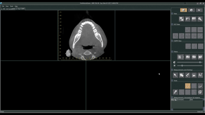 Dual-MPR tab in the CBCT viewer showing the axial arch view at top and two empty slice-view panels split side by side below, ready for two independently traced MPR curves