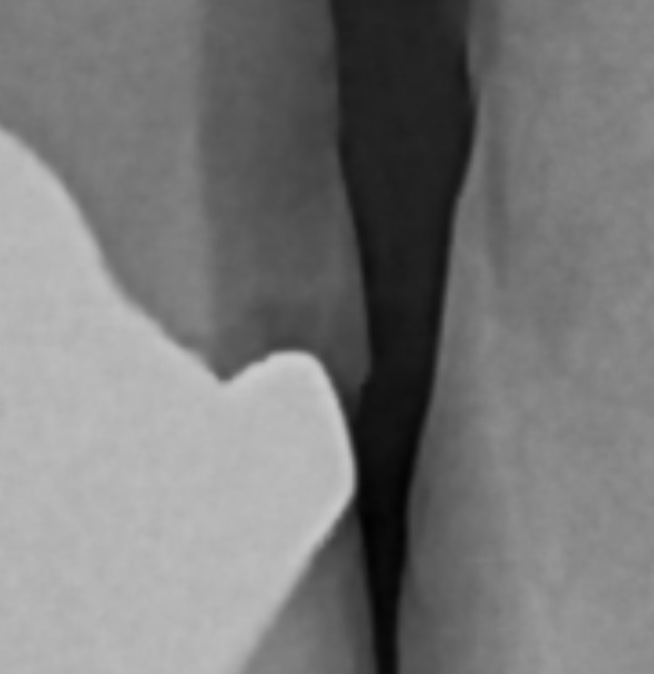 Extreme close-up of a radiograph’s interproximal margin, showing continuous gray-scale tonal gradients rather than hard, geometric filter edges.