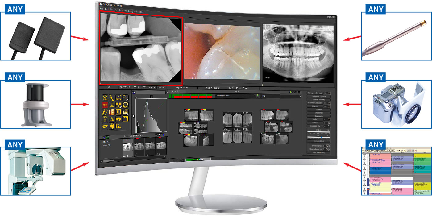 CADI offers advanced integrations with all dental imaging equipment and Practice Management System (PMS) options.