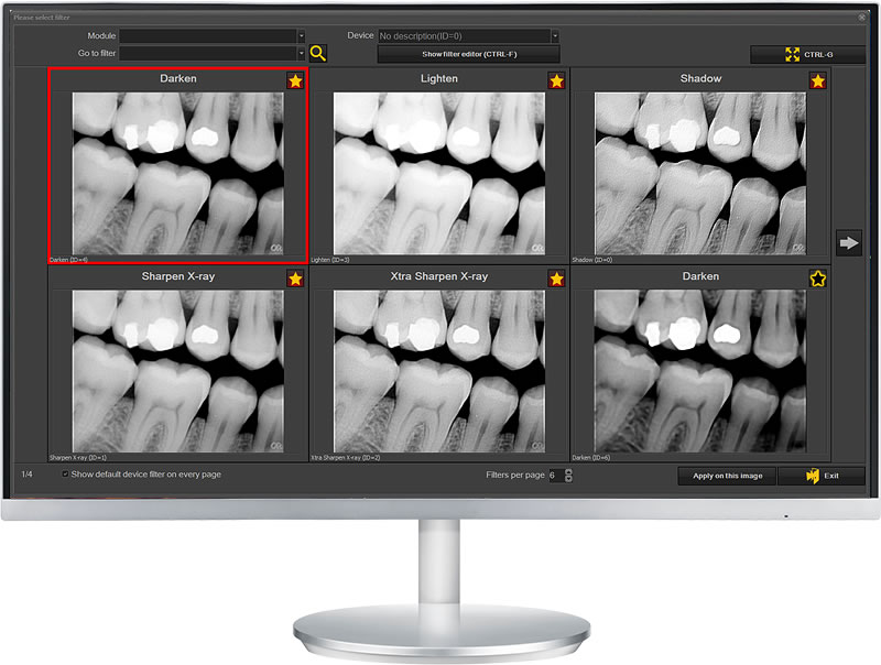 Default filter presets are fully customizable for your specific imaging devices. Dental TI can help you unlock better image quality from your existing sensors with CADI 8 software.