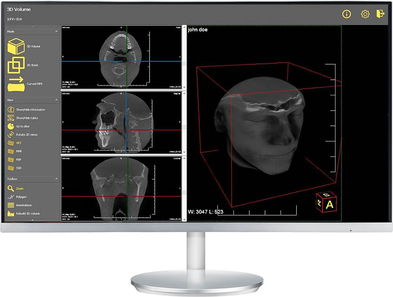 3D Imaging Features in CADI 8 (optional add-on)