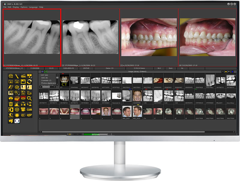 CADI Global Library with case images added for quick access.
