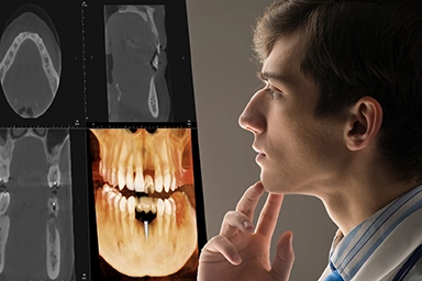 CBCT is a Valuable Tool for Dentistry