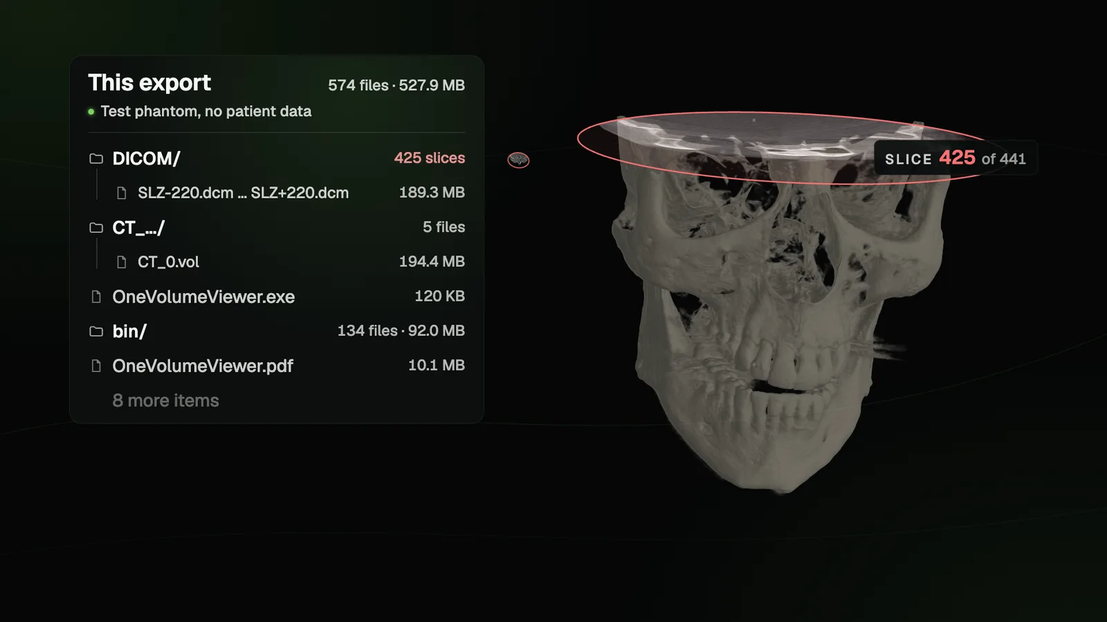 The file tree of a CBCT export with its DICOM folder, the volume file and One Volume Viewer, beside the head volume being sliced
