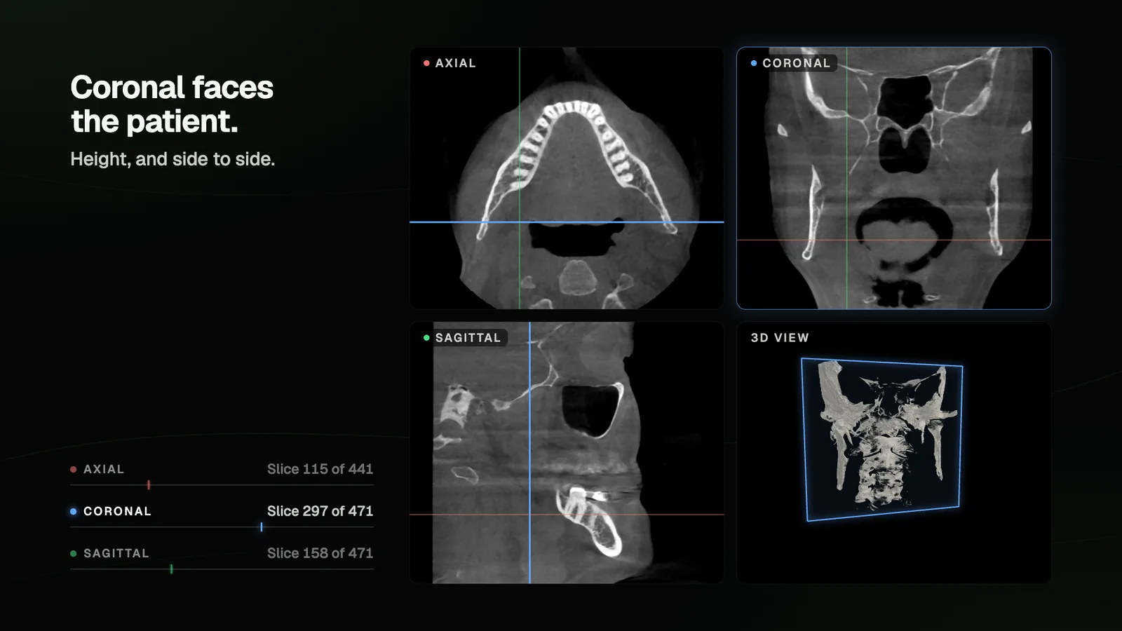A CBCT viewer with axial, coronal and sagittal slices of a head phantom and a 3D view, each pane showing the other planes as colored reference lines