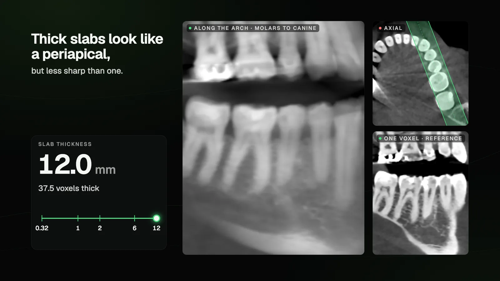 A 12 mm CBCT slab laid along the lower posterior teeth, reading like a periapical from the molars to the canine