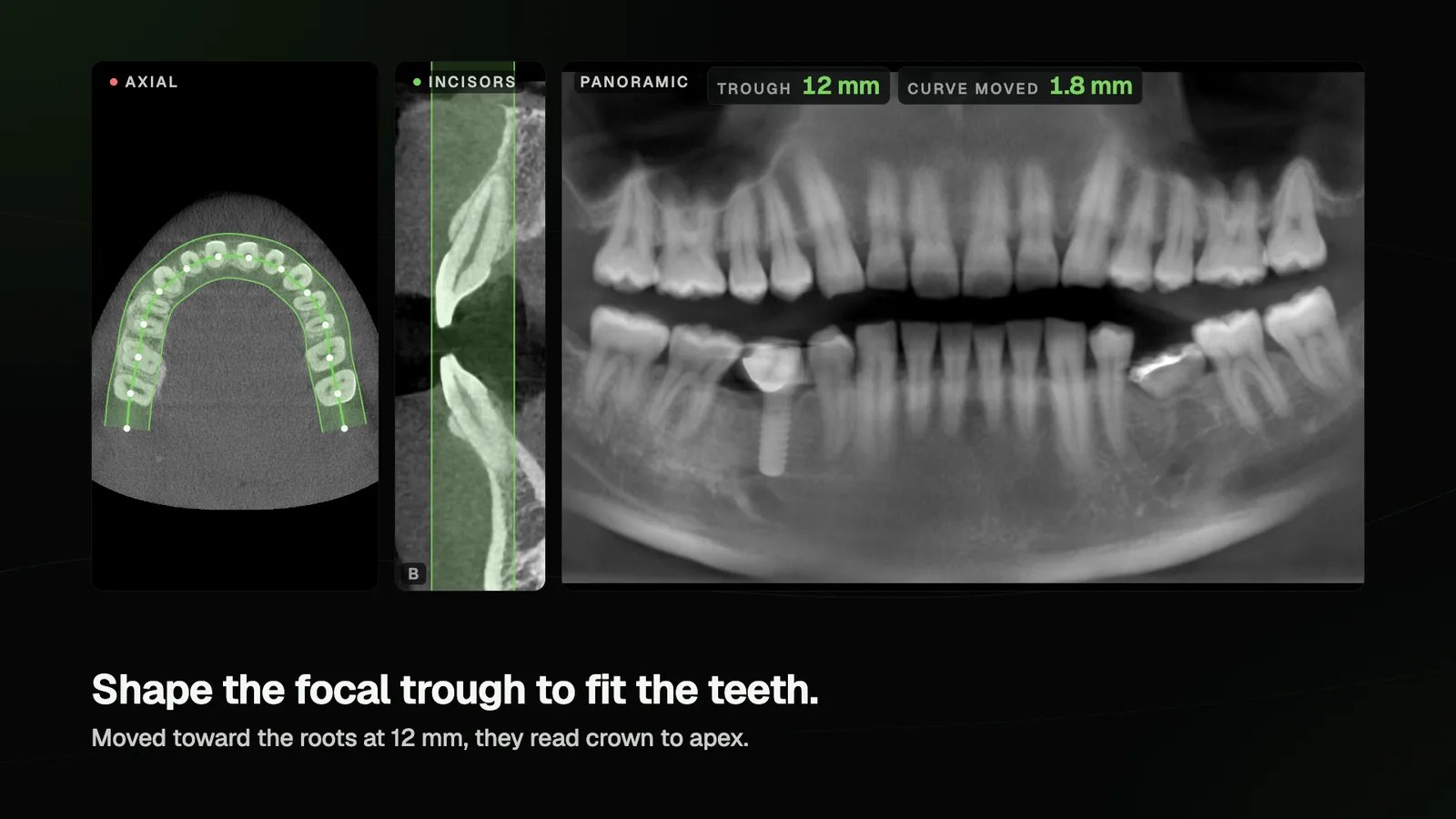 An arch traced on an axial CBCT slice, a section through the incisors showing the 12 mm focal trough, and the panoramic built from it with the front teeth crown to apex