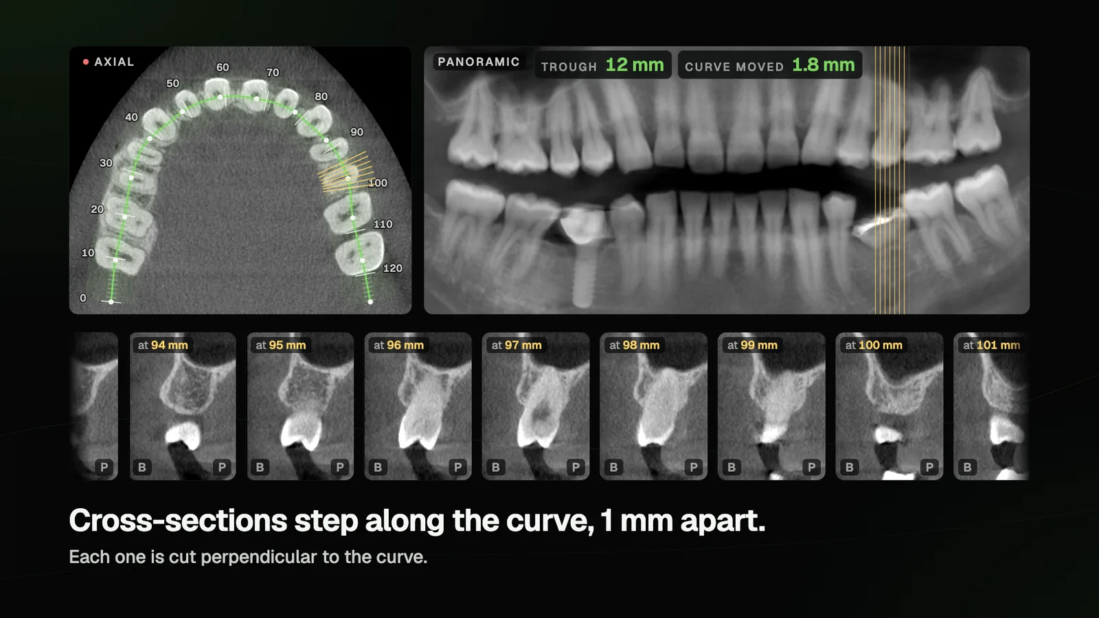 Bucco-palatal cross-sections stepping 1 mm apart along the traced curve, with numbered ticks on the axial slice and the panoramic