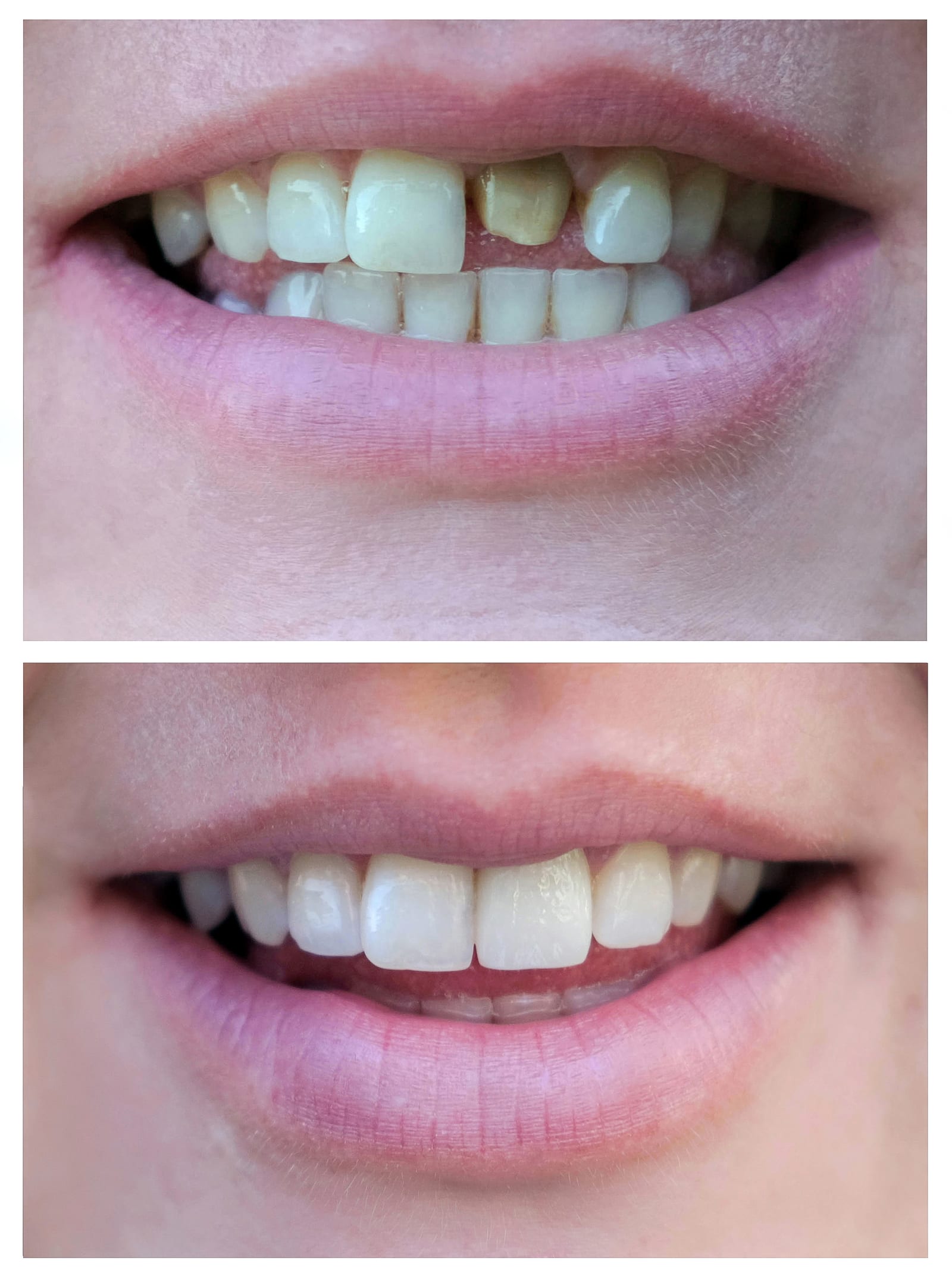 Before and after photos to take home.