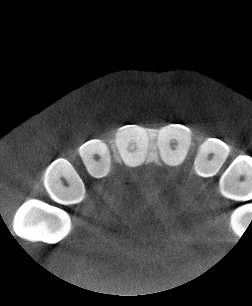 Axial view of the anterior dentition