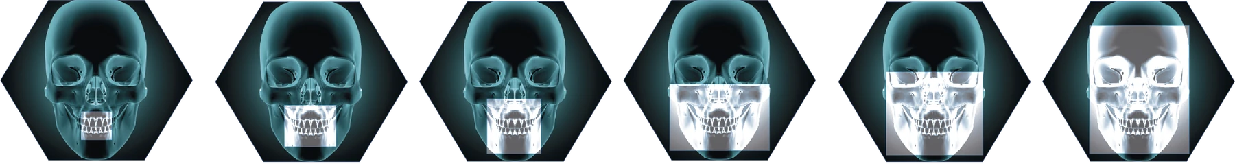 Illustrated anatomical coverage for the 5 × 5 cm field of view